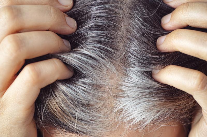 Zapomeňte na barvy na vlasy: Odborníci odhalili potraviny, díky kterým šediny přicházejí mnohem později