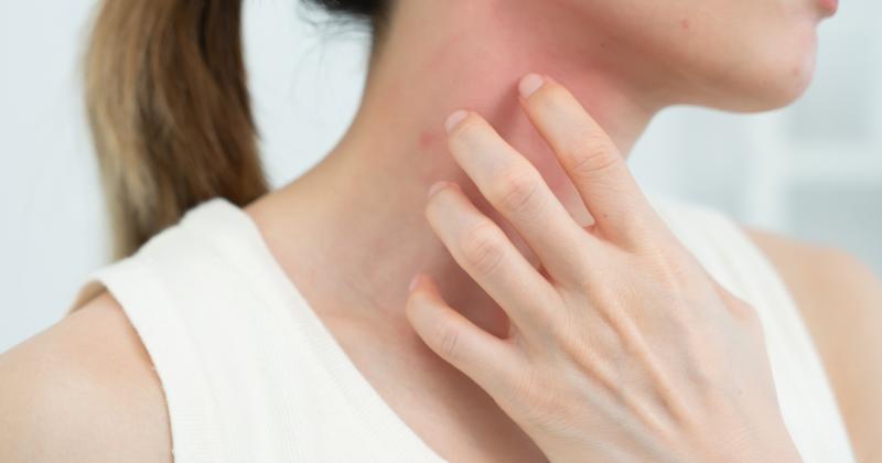 Svědí vás kůže bez vyrážky? Může jít o první tichý signál cukrovky